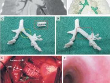 Imágenes de la pieza creada por la impresora 3D