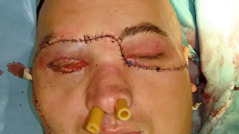 El joven polaco, tras la operación El joven polaco, tras la operación