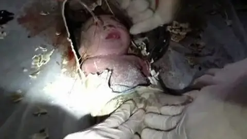Bebé chino rescatado dentro de una tubería Bebé chino rescatado dentro de una tubería