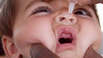 Un niño recibe la vacuna de la polio