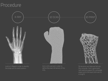 Proceso de elaboración de la estructura de nylon