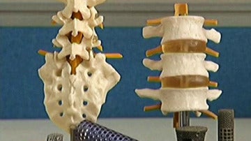 Huesos impresos en 3D
