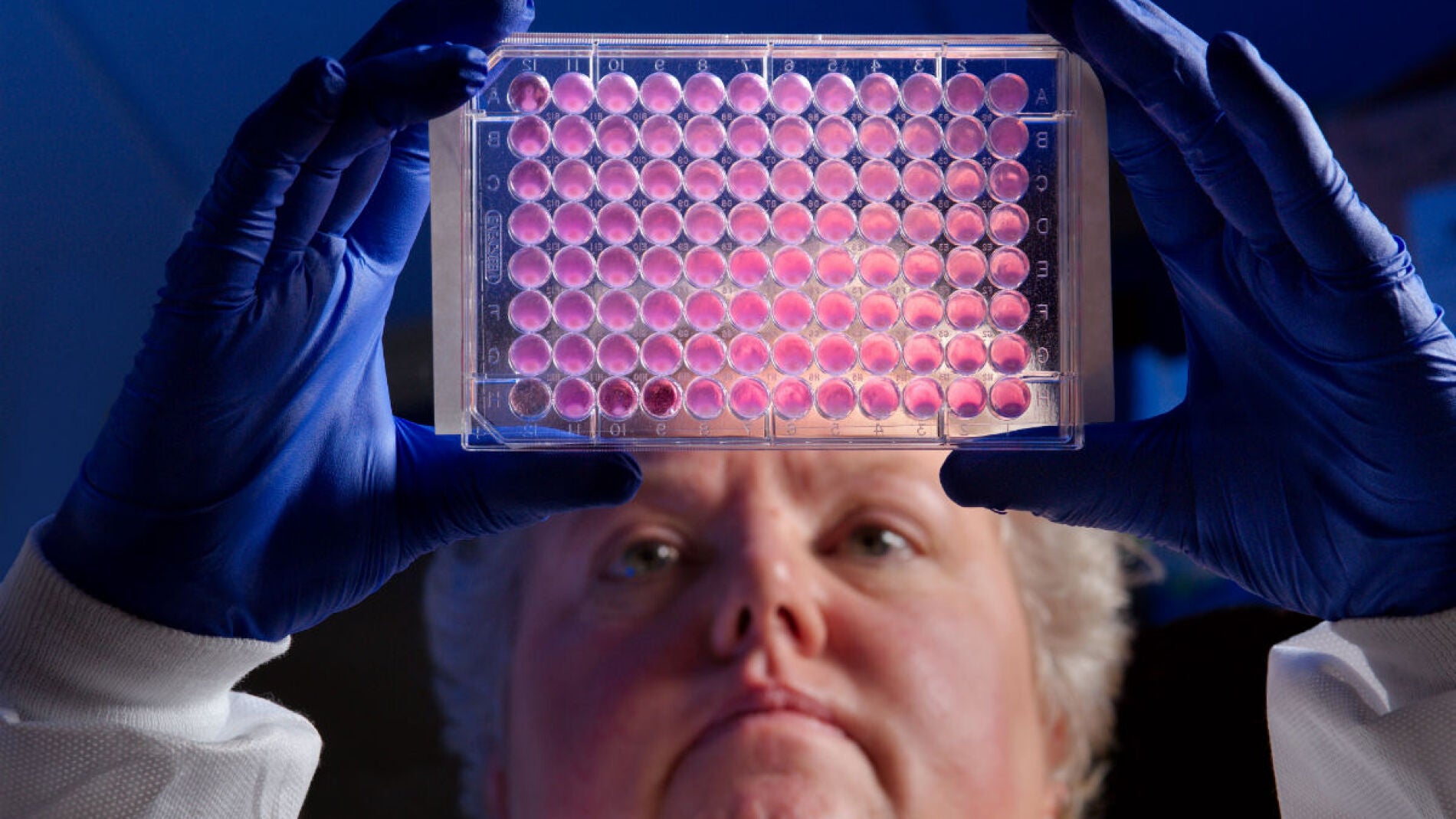 Superbacterias