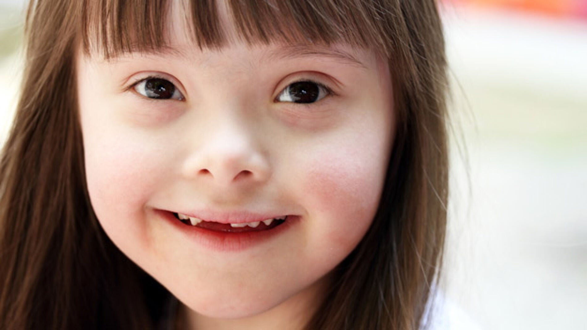 Ni&ntilde;a con S&iacute;ndrome de Down