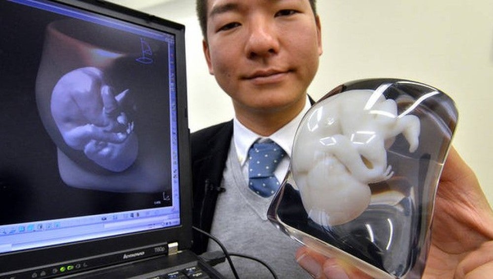 Imagen del modelo impreso en 3D de un feto, a partir de una ecografía