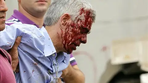 Maquinista herido Maquinista herido