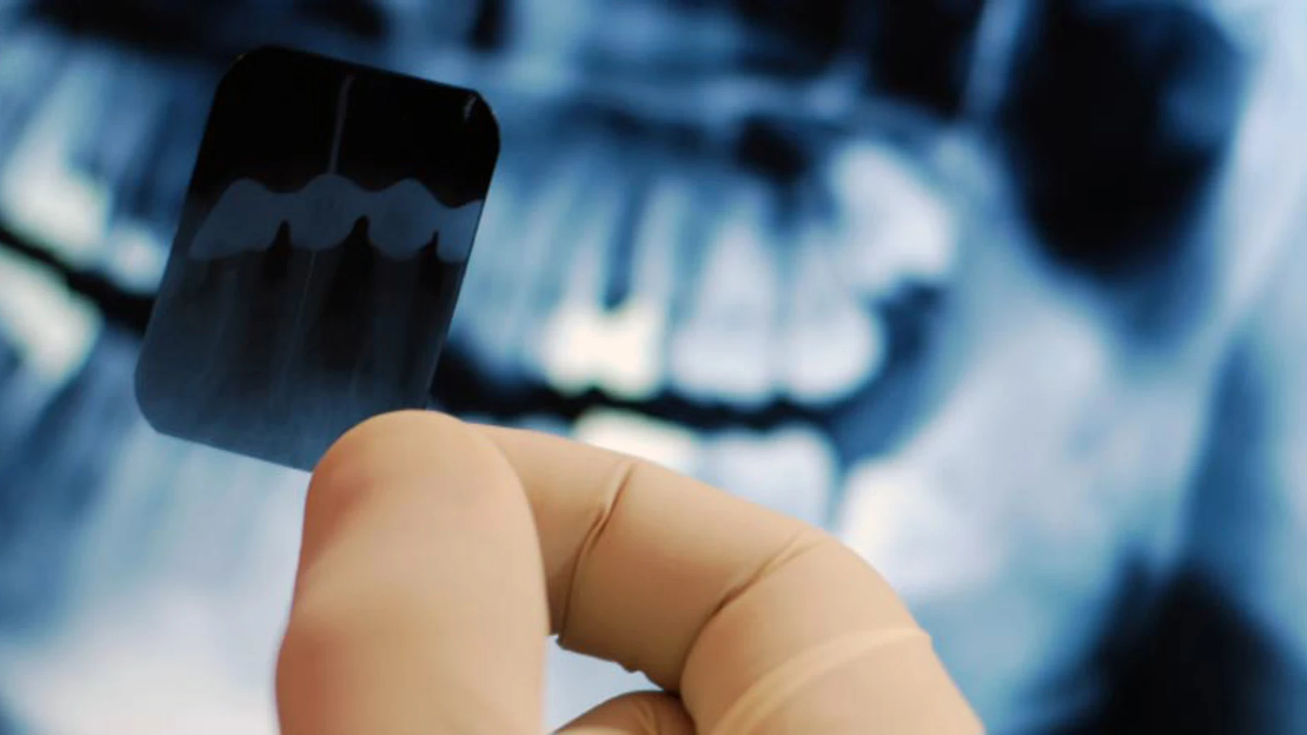 Radiografía dental Radiografía dental