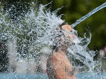 La hiperhidrosis no tiene cura, pero hay tratamientos que controlan el sudor excesivo La hiperhidrosis no tiene cura, pero hay tratamientos que controlan el sudor excesivo