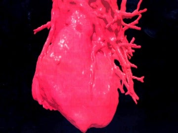 Corazón humano en 3D