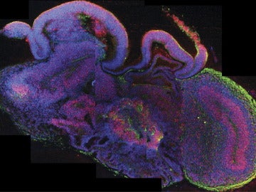 El desarrollo de varias regiones del cerebro, con las células madre en rojo.