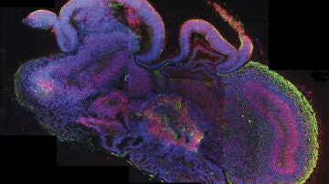 El desarrollo de varias regiones del cerebro, con las células madre en rojo.