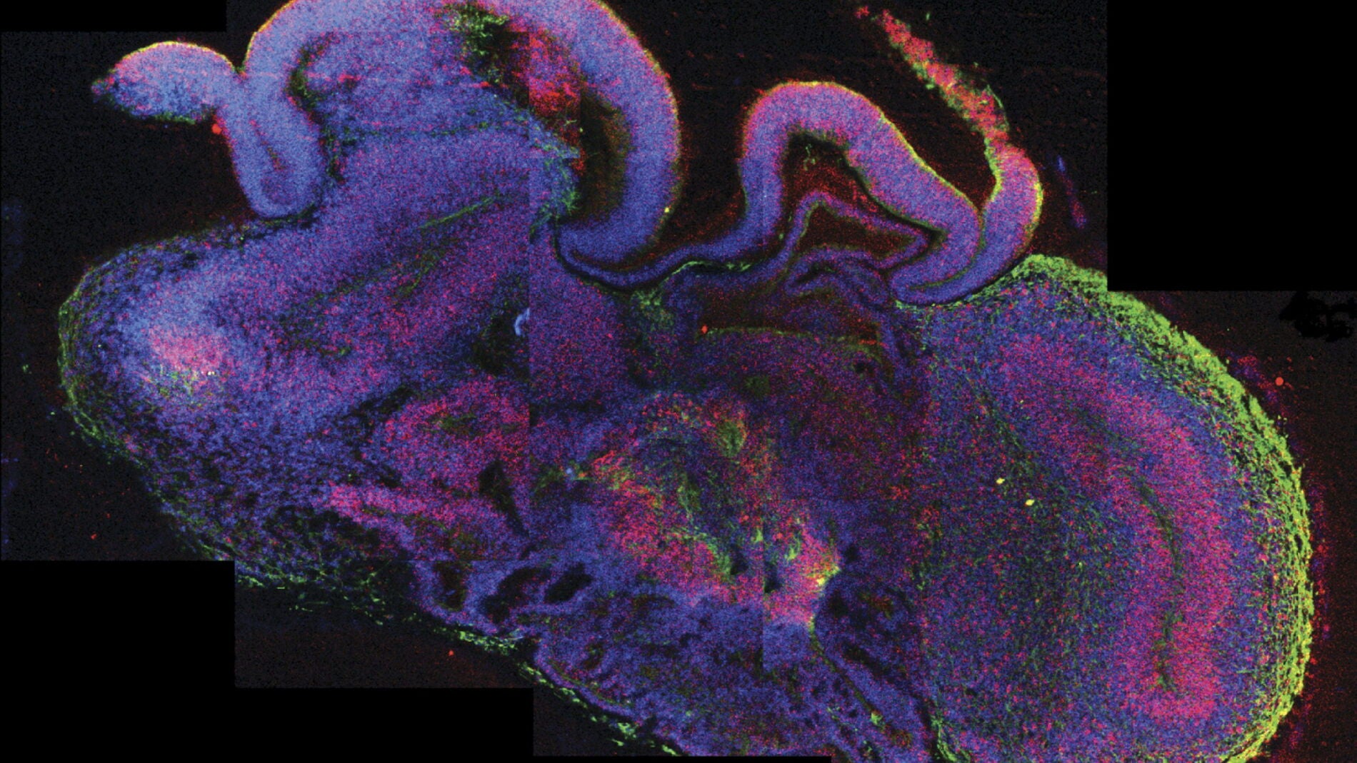 El desarrollo de varias regiones del cerebro, con las c&eacute;lulas madre en rojo.