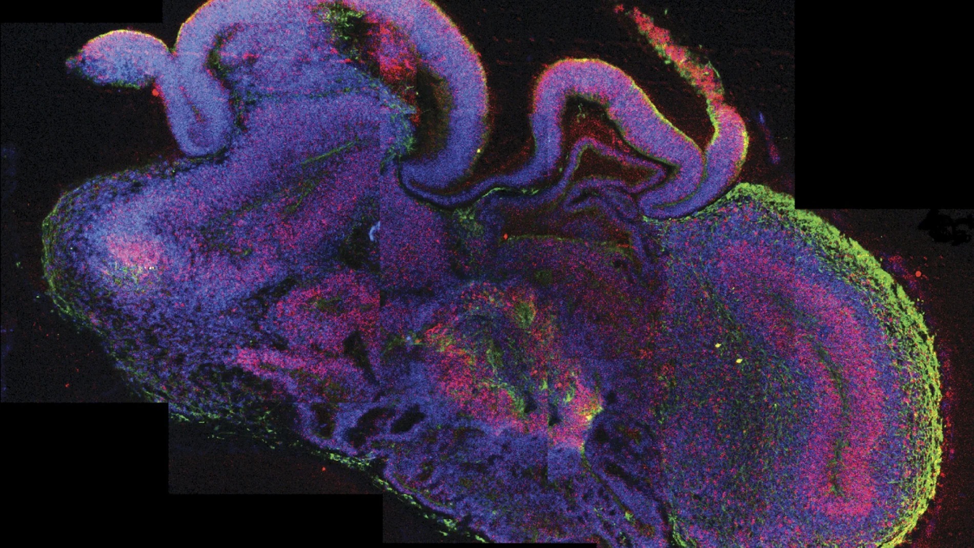 El desarrollo de varias regiones del cerebro, con las células madre en rojo. El desarrollo de varias regiones del cerebro, con las células madre en rojo.