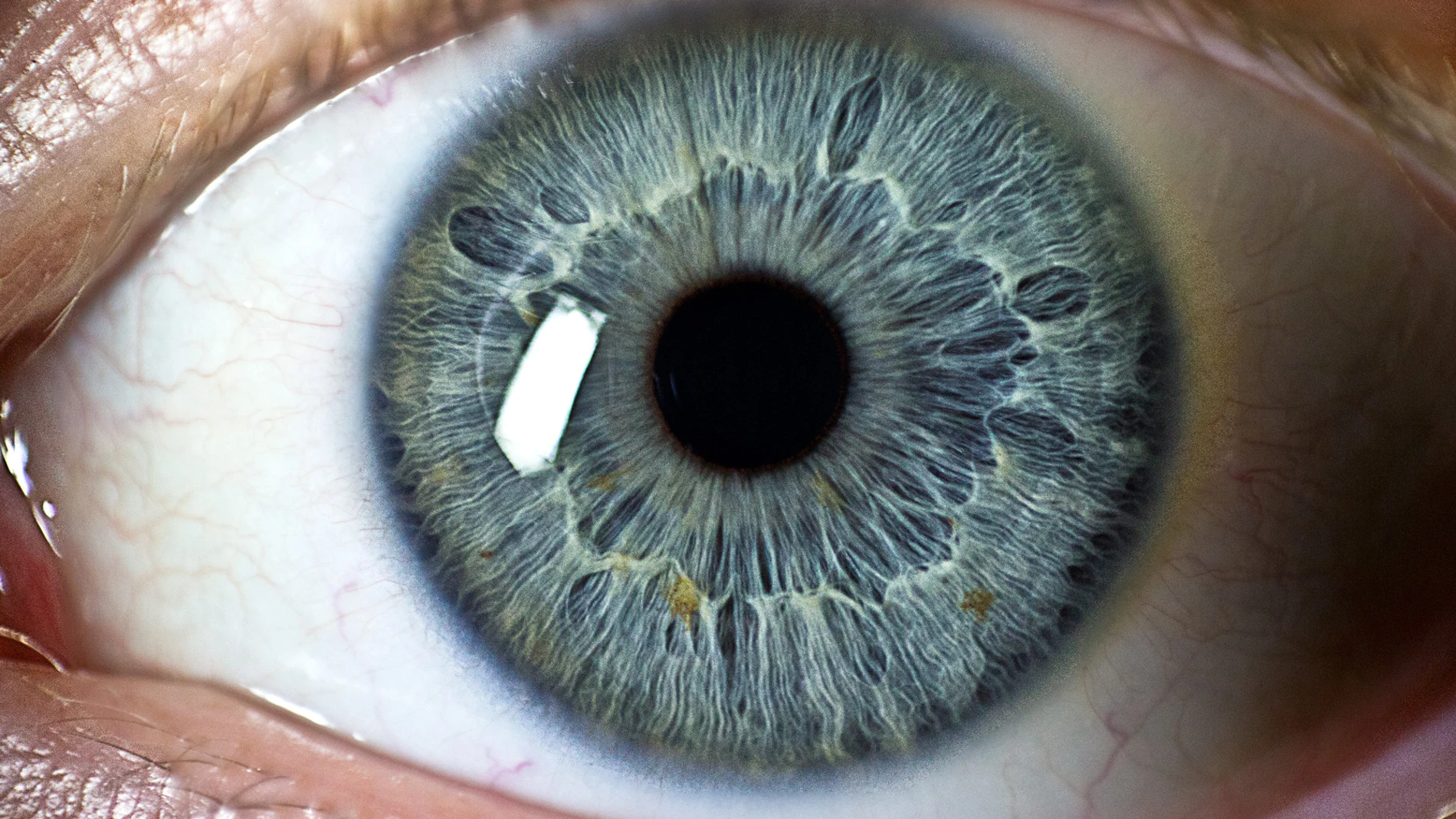 Imagen de un ojo Imagen de un ojo