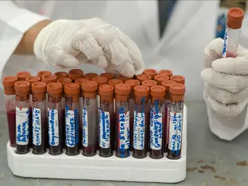 Investigaciones sobre el Sida Investigaciones sobre el Sida