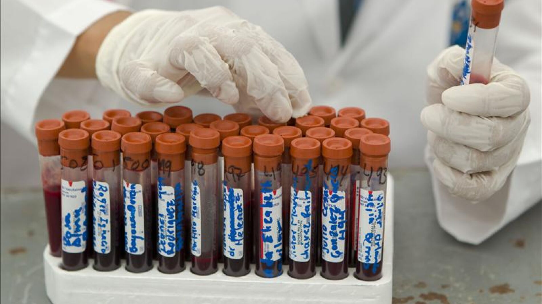 Investigaciones sobre el Sida