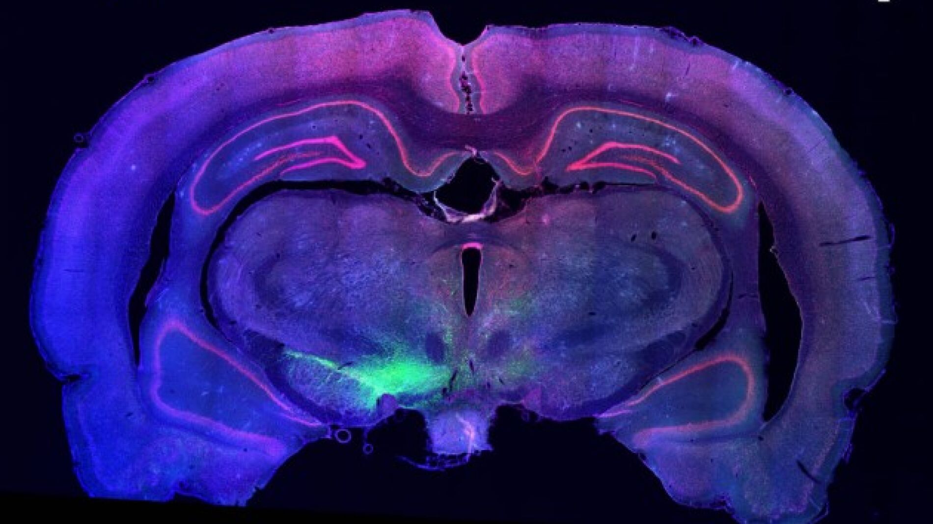 El trasplante de neuronas dopamin&eacute;rgicas podr&iacute;a revertir el da&ntilde;o que el p&aacute;rkinson hace en estas c&eacute;lulas