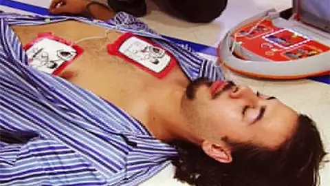 Una persona es reanimada con el uso de un desfirbilador Una persona es reanimada con el uso de un desfirbilador