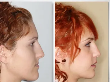 Cirugía estética Cirugía estética