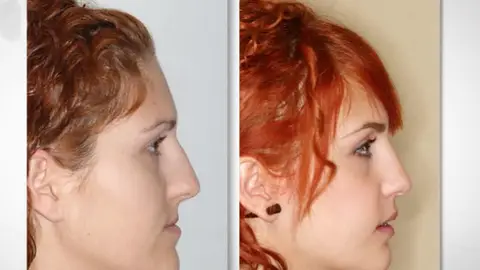 Cirugía estética Cirugía estética