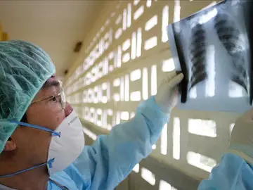Médico observa una radiografía Médico observa una radiografía