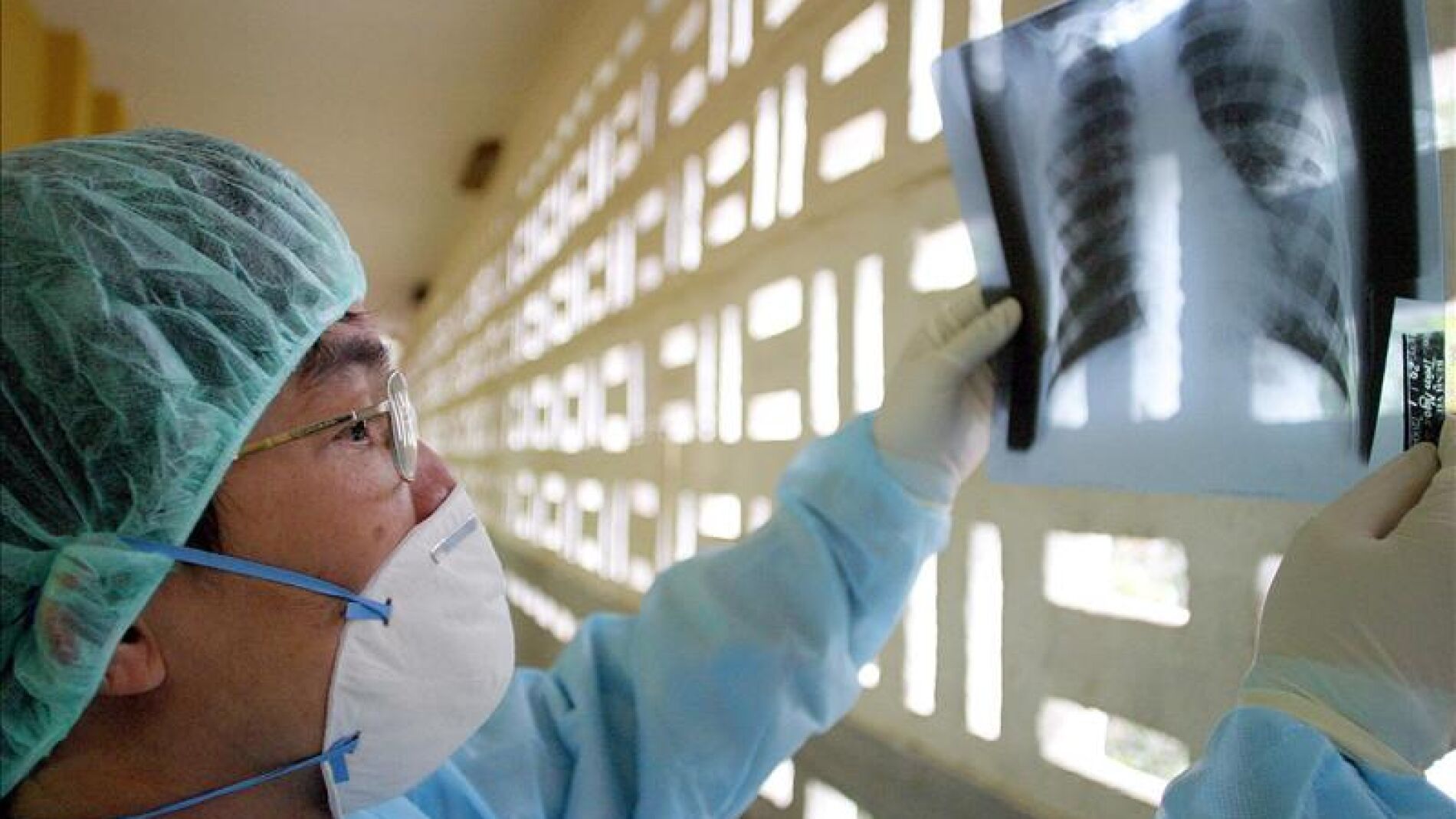 M&eacute;dico observa una radiograf&iacute;a