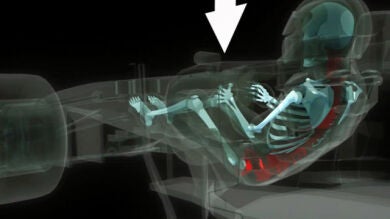 ¿Qué es la fuerza G?