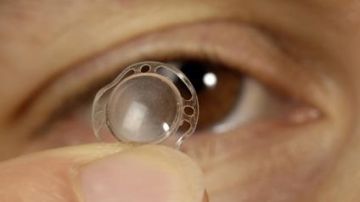 Implantan por primera vez en España una córnea artificial