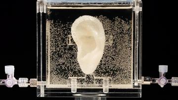 Reconstrucción de la oreja de Van Gogh