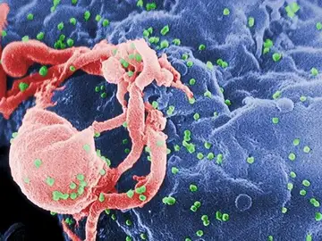 Investigan la proteína capaz de bloquear el ciclo vital del VIH en algunos pacientes Investigan la proteína capaz de bloquear el ciclo vital del VIH en algunos pacientes