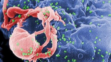 Investigan la proteína capaz de bloquear el ciclo vital del VIH en algunos pacientes