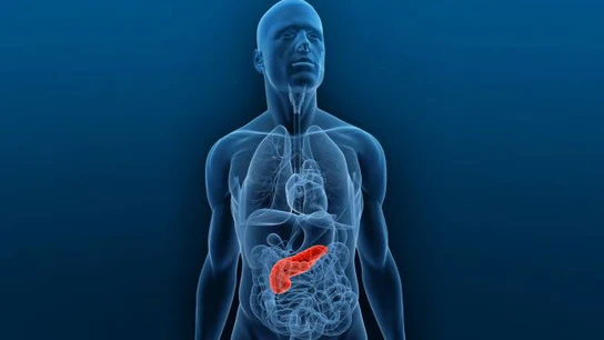 Cáncer de páncreas Cáncer de páncreas