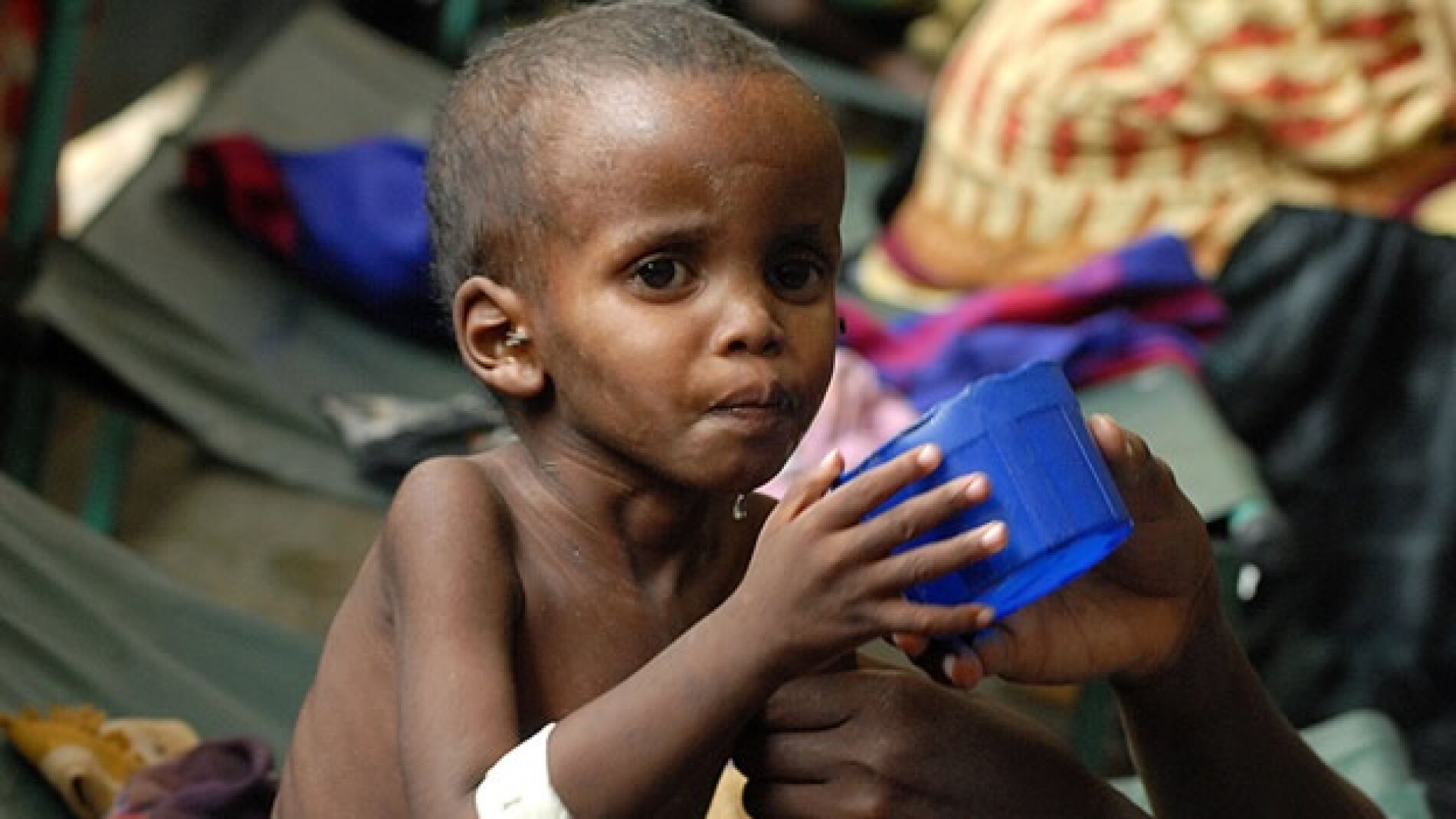 Ni&ntilde;o afectado por la crisis alimentaria en Somalia