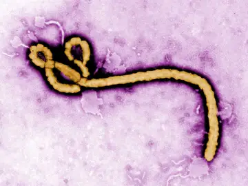 Virus ébola Virus ébola