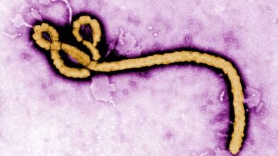 Científicos tailandeses hallan un nuevo anticuerpo contra el ébola 