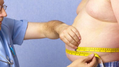 La obesidad ocasiona problemas de fertilidad tanto en hombres como en mujeres