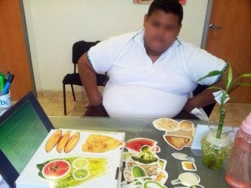 Realizan en México bypass gástrico a un menor que pesaba 191 kilos Realizan en México bypass gástrico a un menor que pesaba 191 kilos
