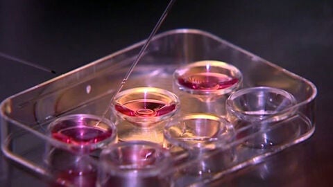 Congelaci&oacute;n de &oacute;vulos