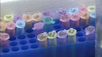 Tratamientos paliativos y experimentales para los enfermos infectados con el ébola