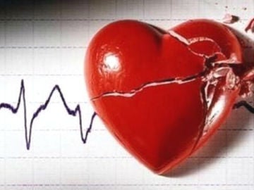 La miocardiopatía hipertrófica, una de las principales causas de muerte súbita.