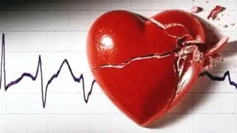 La miocardiopatía hipertrófica, una de las principales causas de muerte súbita. La miocardiopatía hipertrófica, una de las principales causas de muerte súbita.