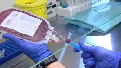 España pondrá en marcha un pionero ensayo para curar el VIH con trasplante de sangre de cordón umbilical