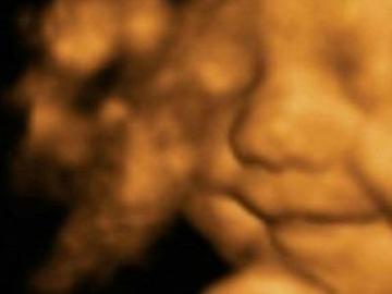 Una ecografía en 4D de un bebé sonriendo