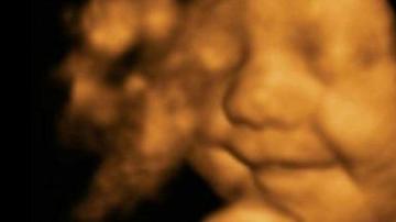 Una ecografía en 4D de un bebé sonriendo