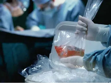 Trasplante de órganos Trasplante de órganos