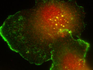 Células tumorales humanas de cáncer de m