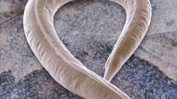 Imagen microscópica de un gusano nematodo. 