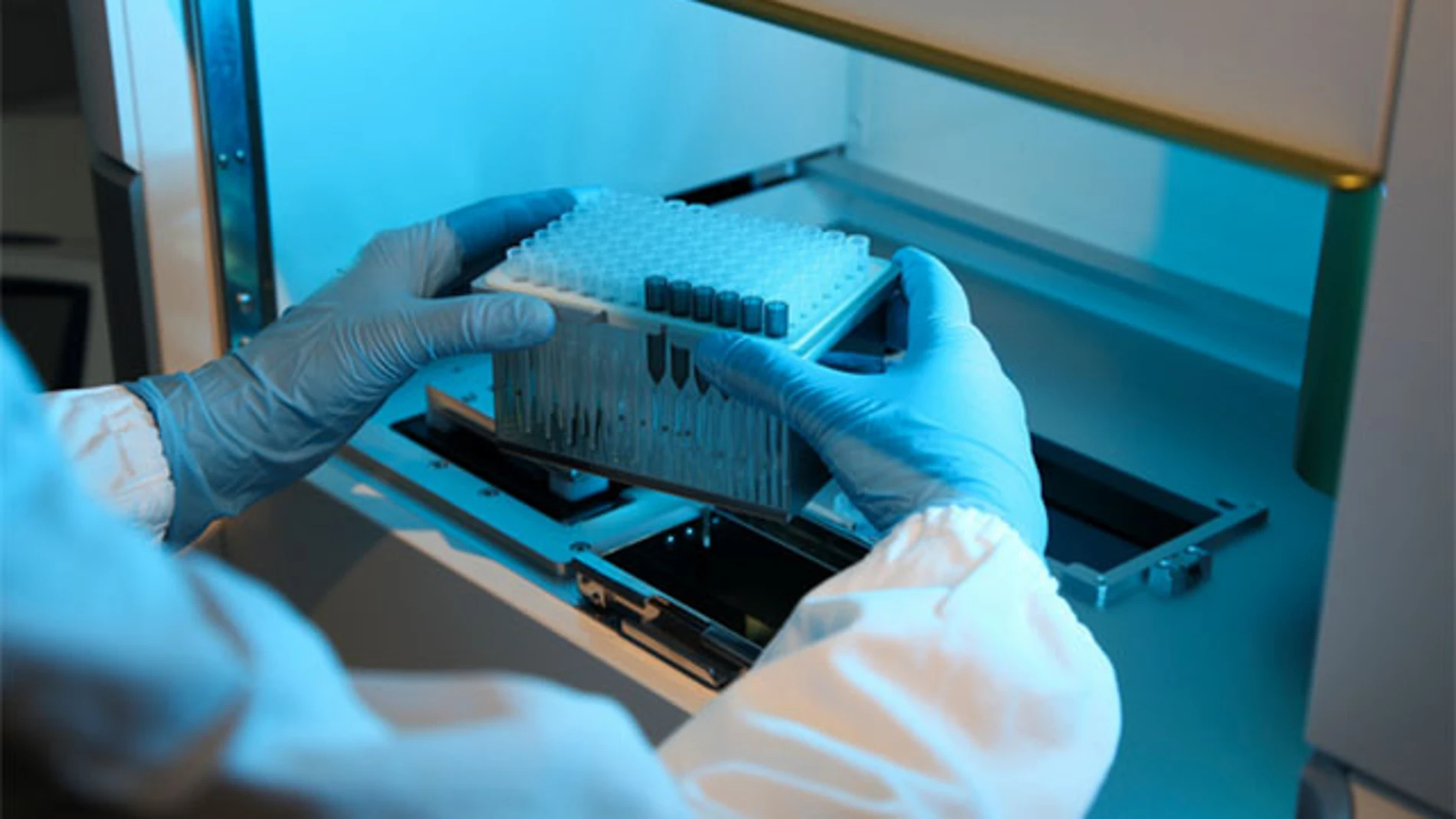 La Universidad de Guadalajara patenta un dispositivo de calor contra el cáncer La Universidad de Guadalajara patenta un dispositivo de calor contra el cáncer