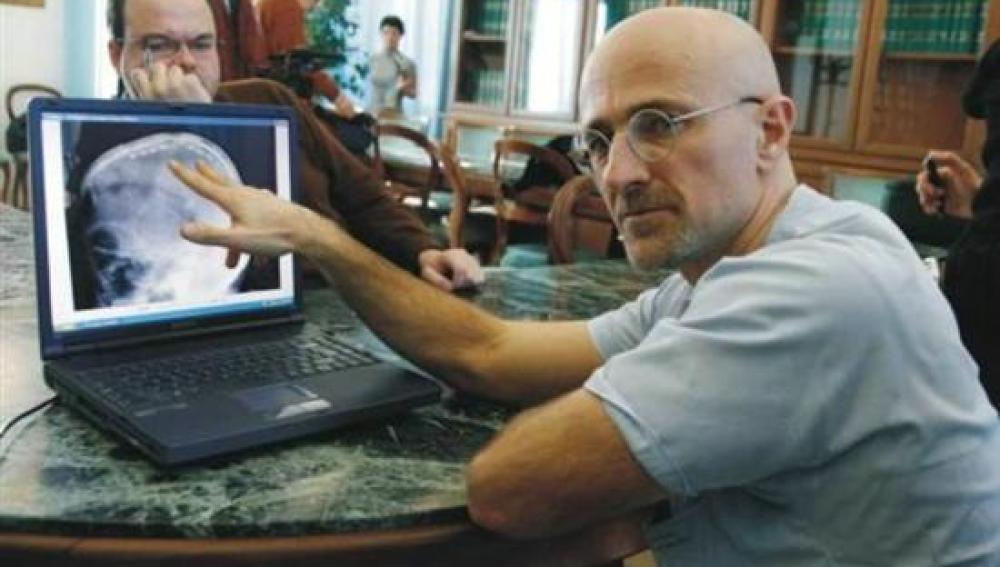 Sergio Canavero, médico italiano