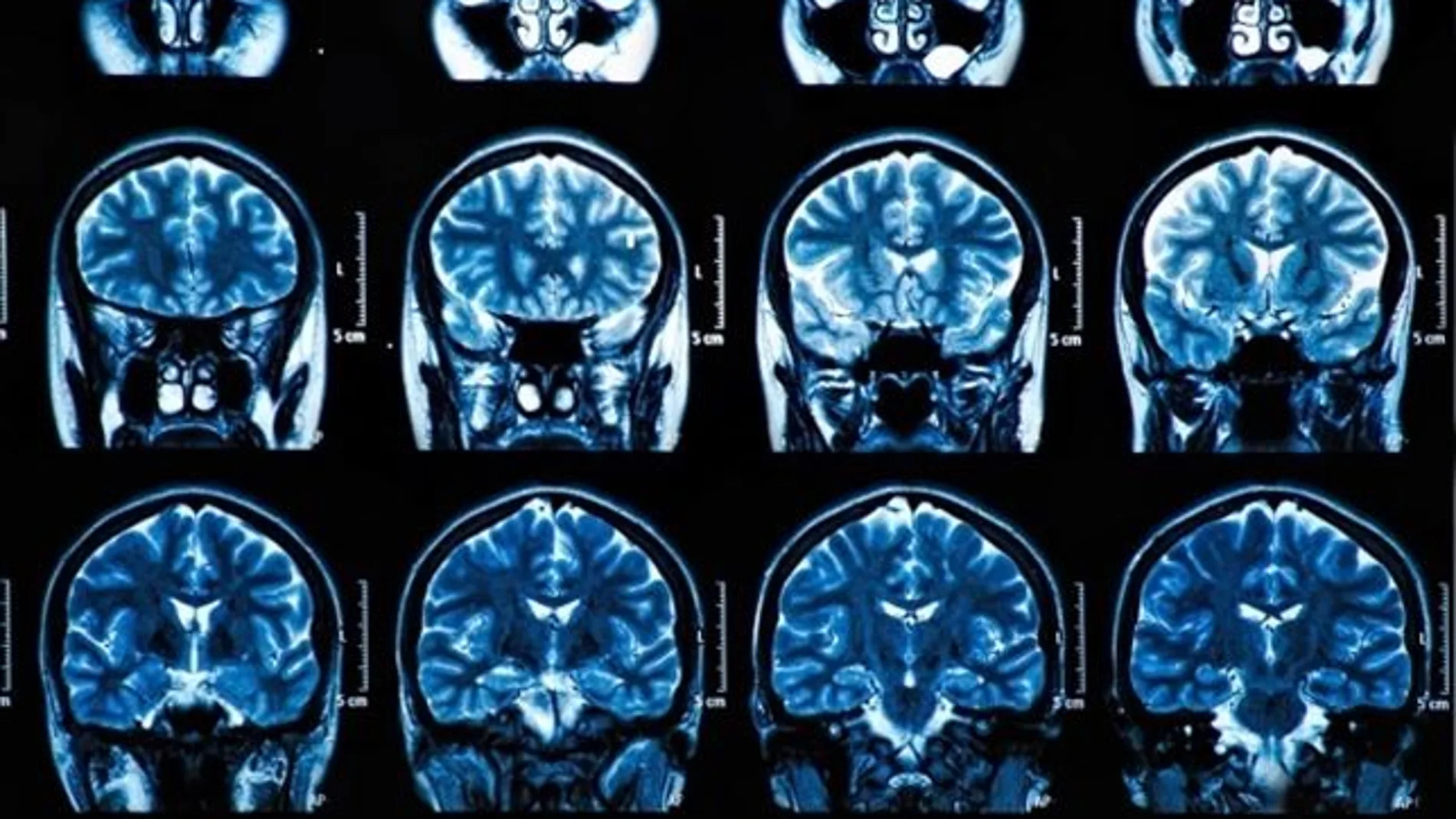 Escáner cerebral Escáner cerebral